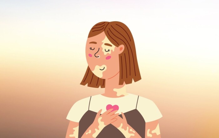 ACCEPTANCE Panic Attack